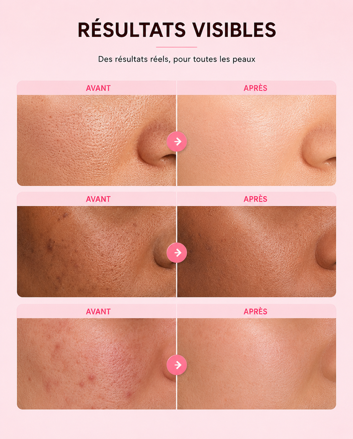 ROSEA PINK PADS